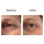 Peptilux - kortsuvastane 'shock action effect' silmaümbruskreem LIPHASYN™-iga - 4