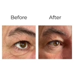 Peptilux - kortsuvastane 'shock action effect' silmaümbruskreem LIPHASYN™-iga - 5