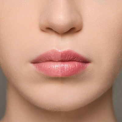 Supreme huulehooldus - Strawberry